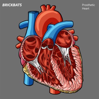 Prosthetic Heart