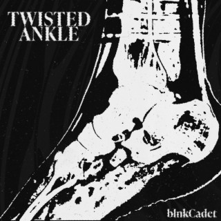 Twisted Ankle