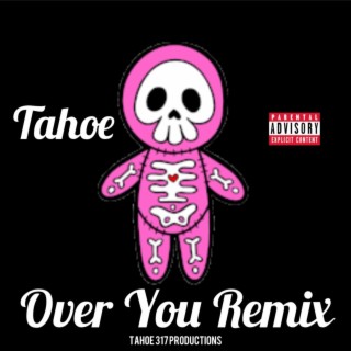 Over You (Remix)
