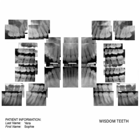 wisdom teeth