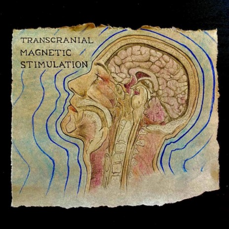 TMS (Transcranial Magnetic Stimulation)