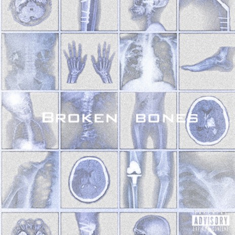 Broken Bones ft. Deyaz | Boomplay Music