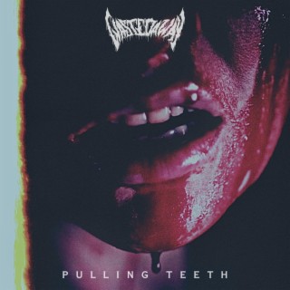 PULLING TEETH