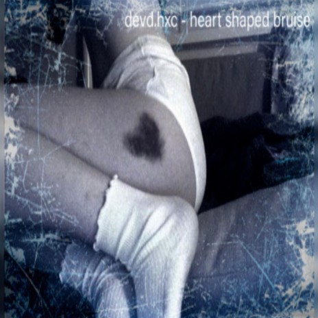 heart shaped bruise | Boomplay Music