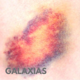 Galaxias