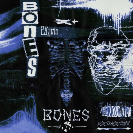 Bones ft. Rokit | Boomplay Music