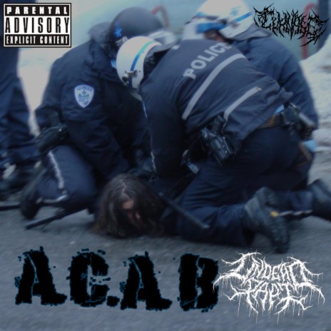 A.C.A.B ft. Undead Papi | Boomplay Music