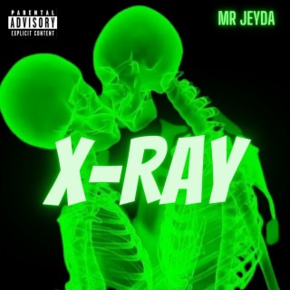 X-Ray