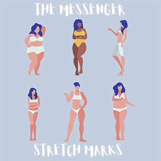 Stretch Marks