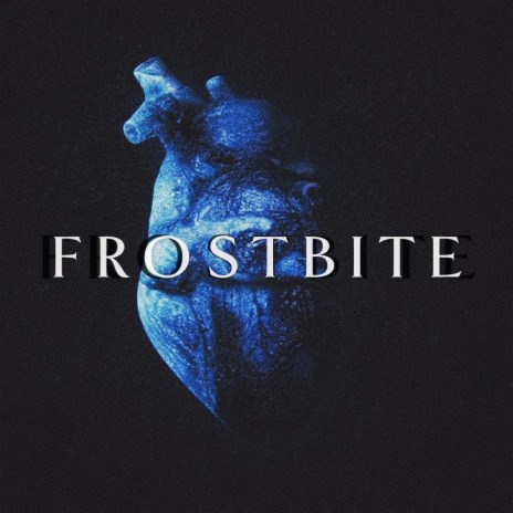 FROSTBITE | Boomplay Music