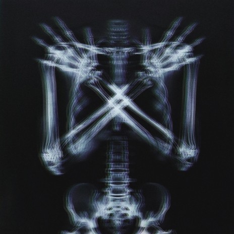 x-ray | Boomplay Music