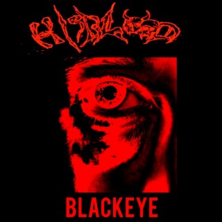 blackeye