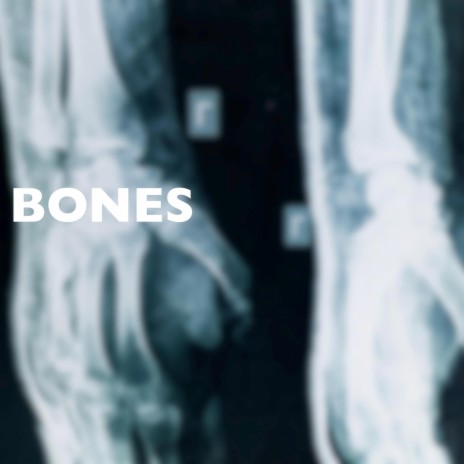 Bones | Boomplay Music