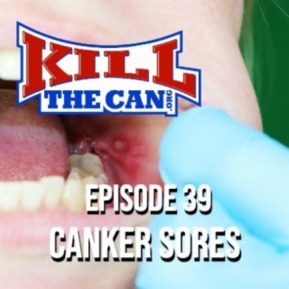 Episode 39 - Canker Sores