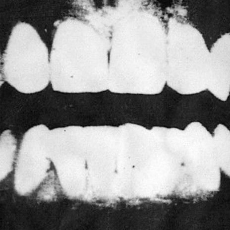 Pulling teeth | Boomplay Music