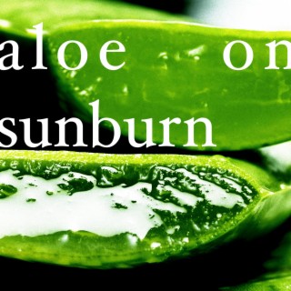 aloe on sunburn