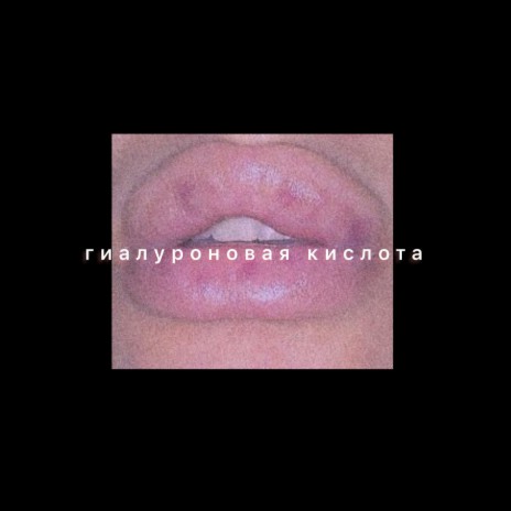 Gialuronovaya kislota | Boomplay Music