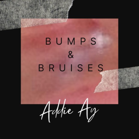 Bumps & Bruises | Boomplay Music