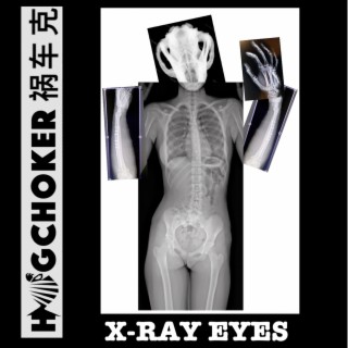 X-Ray Eyes