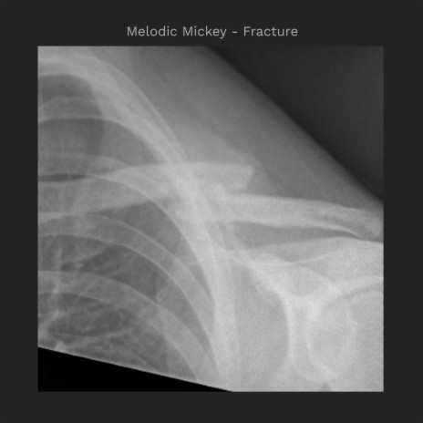 Fracture | Boomplay Music