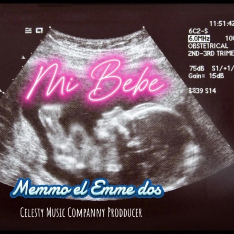 Mi Bebe ft. Memmo el Emme Dos | Boomplay Music