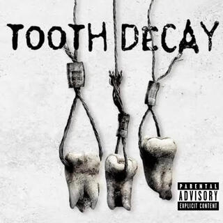 TOOTH DECAY