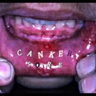 Canker Sore