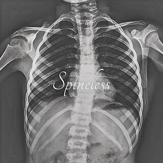 Spineless