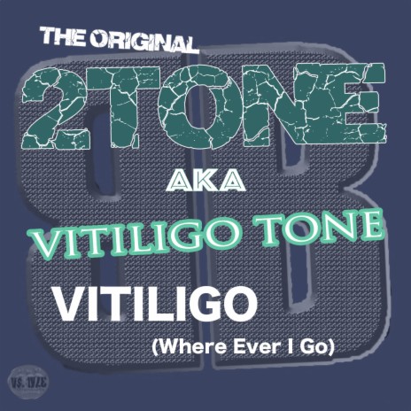 Vitiligo (Where Ever I Go) Vitiligo Music | Boomplay Music