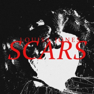 Scars