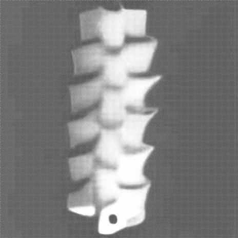 STYROFOAM SPINE | Boomplay Music