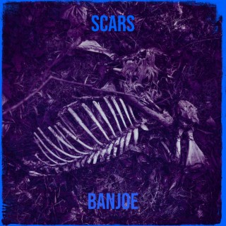 Scars