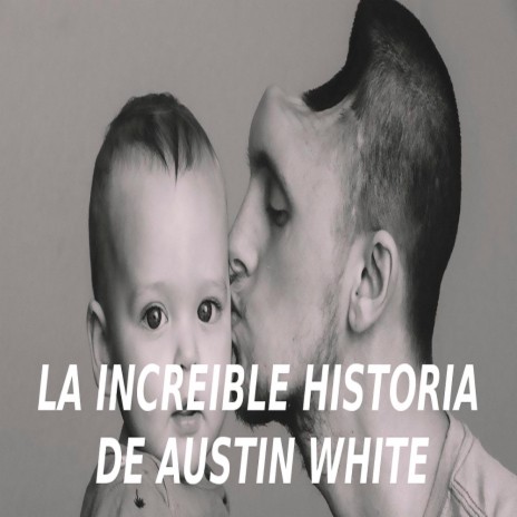 La increible historia de Austin White