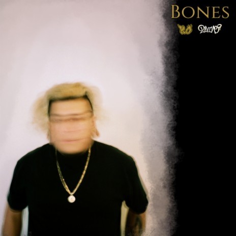 Bones