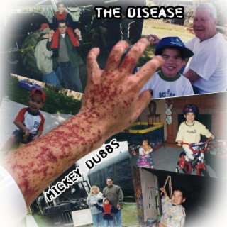 The Disease