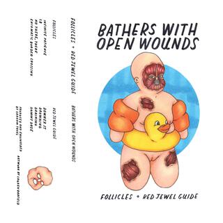 Bathers with Open Wounds