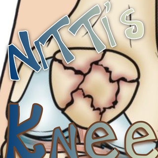 NiTTi's knee