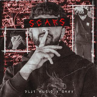 SCARS