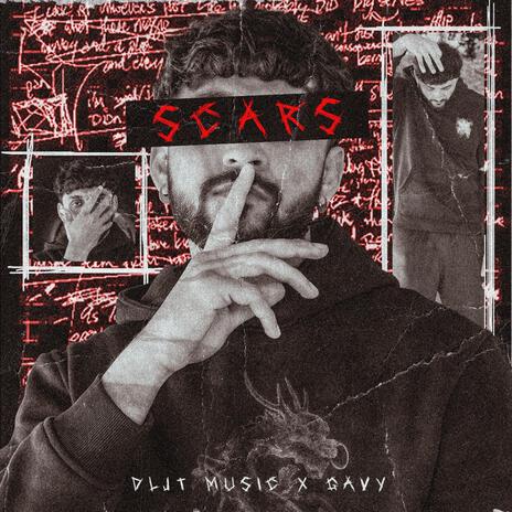 SCARS ft. DLJT | Boomplay Music