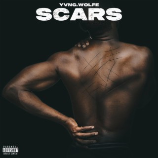 SCARS