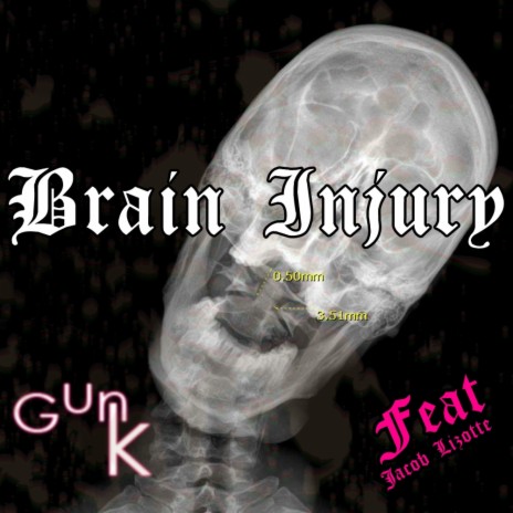 Brain Injury | Boomplay Music