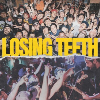 Losing Teeth