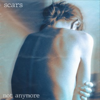 Scars