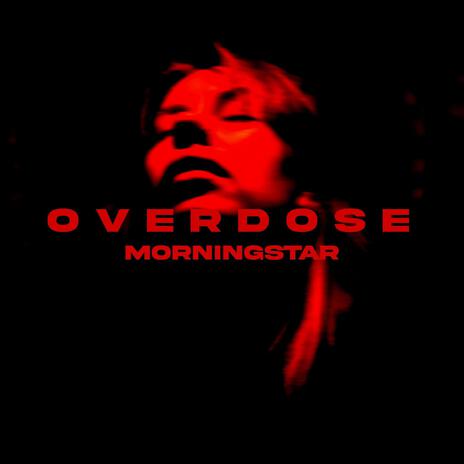 OVERDOSE | Boomplay Music