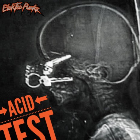 Acid Test 2016A001 | Boomplay Music