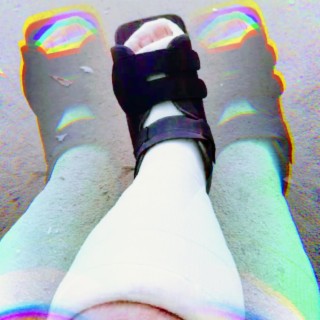 Broken Foot