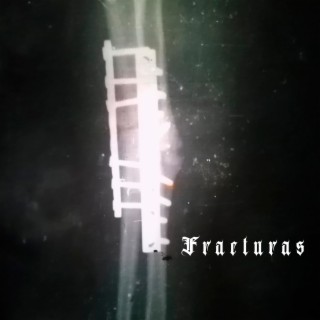 Fracturas