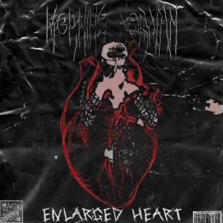 enlarged heart