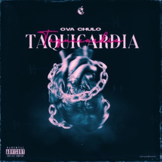 Taquicardia