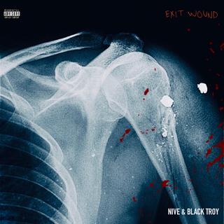 EXIT WOUND